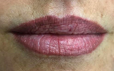 Caso real maquillaje permanente labios 